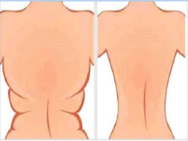 Bài tập giảm mỡ lưng hành động đúng, đốt mỡ sâu